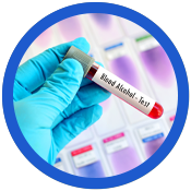 Blood alcohol testing