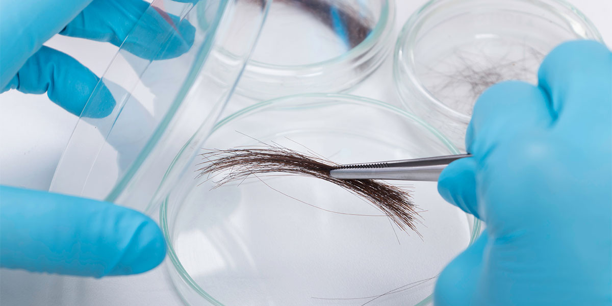 Hair drug testing: Patterns of use, single events and limitations